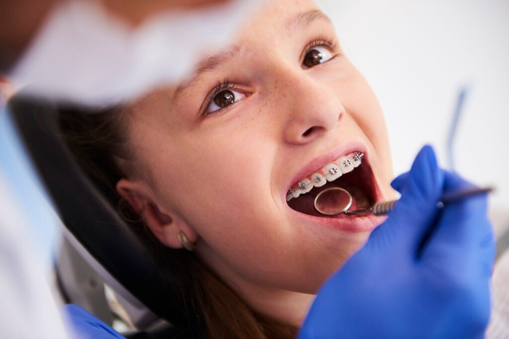 A girl representing dental care for teeth braces in Brentwood
