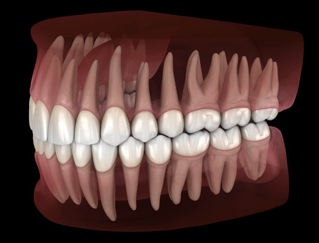 How Teeth Form in Brentwood