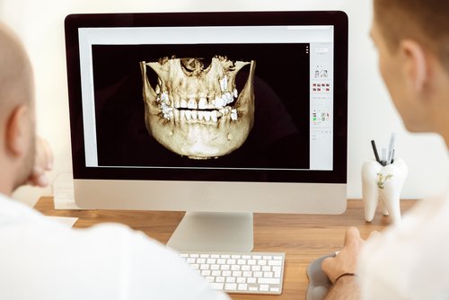 The Benefits of Digital X-Rays
